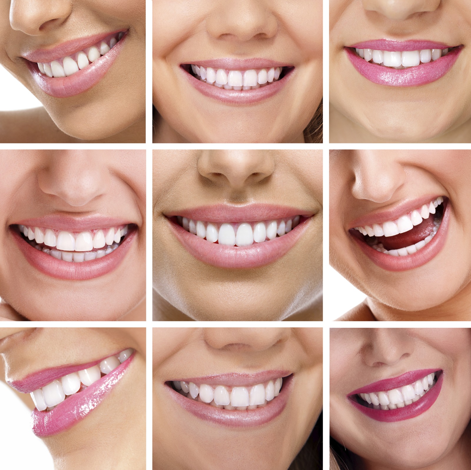 Imagen de estética dental