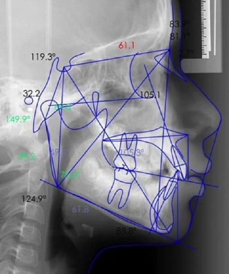 Imagen de estudios cefalometricos