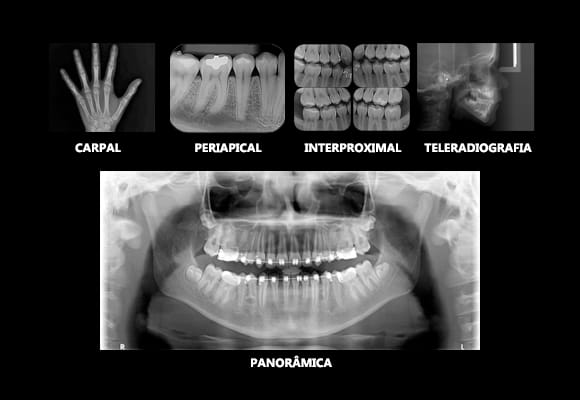 Imagen de radiografias odontologicas